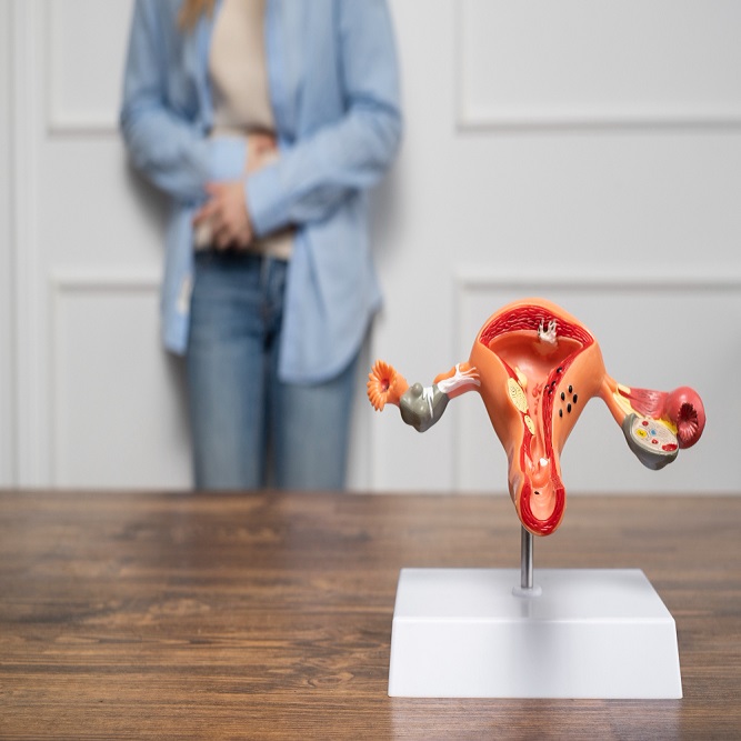 Polycystic-ovarian-syndrome